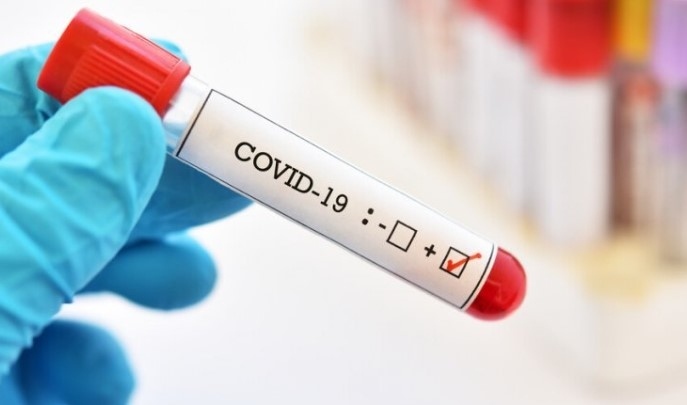 654 са новите случаи на коронавирус